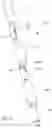 Fig. 05 - Lint removing device