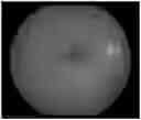 Fig. 01 - Artificial neural network and system for identifying lesion in retinal fundus image