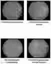 Fig. 10 - Artificial neural network and system for identifying lesion in retinal fundus image
