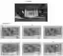 Fig. 12 - Three-dimensional integrated stretchable electronics