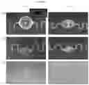 Fig. 26 - Three-dimensional integrated stretchable electronics