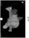 Fig. 09 - COMPOSITIONS, METHODS AND SYSTEMS FOR IDENTIFYING THE POSITION AND ORIENTATION OF THE ESOPHAGUS IN ATRIAL FIBRILLATION ABLATION PROCEDURES