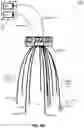 Fig. 10 - Flexible tip optical imaging