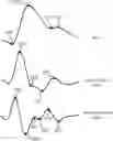 Fig. 01 - Detecting a transient ischemic attack using photoplethysmogram signals