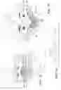 Fig. 12 - Detecting a transient ischemic attack using photoplethysmogram signals
