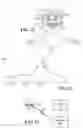 Fig. 26 - Detecting a transient ischemic attack using photoplethysmogram signals