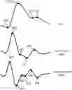 Fig. 01 - Utilizing correlations between PPG signals and iPPG signals to improve detection of physiological responses