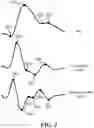 Fig. 04 - Utilizing correlations between PPG signals and iPPG signals to improve detection of physiological responses