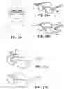 Fig. 09 - Utilizing correlations between PPG signals and iPPG signals to improve detection of physiological responses
