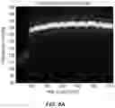 Fig. 07 - Reduction of physiological metric error due to inertial cadence