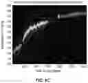 Fig. 09 - Reduction of physiological metric error due to inertial cadence