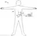 Fig. 01 - Stimulation progamming aid using a sensory projection