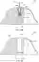 Fig. 03 - SUCTION CUP EKG ELECTRODE