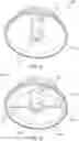 Fig. 05 - SUCTION CUP EKG ELECTRODE