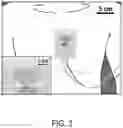 Fig. 04 - DUAL-MODE EPIDERMAL CARDIOGRAM SENSOR