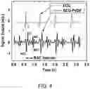 Fig. 05 - DUAL-MODE EPIDERMAL CARDIOGRAM SENSOR