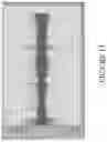 Fig. 14 - Systems and methods for processing electromyographic signals of the gastrointestinal tract
