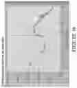 Fig. 31 - Systems and methods for processing electromyographic signals of the gastrointestinal tract