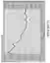 Fig. 32 - Systems and methods for processing electromyographic signals of the gastrointestinal tract