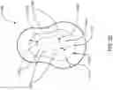 Fig. 19 - ADHESIVE SYSTEMS HAVING AN AGGRESSIVE ADHESIVE OUTER RING ALONG ITS BOTTOM PERIMETER AND HAVING A LOW EFFECTIVE MODULUS OF ELASTICITY