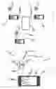 Fig. 02 - Method for determining movement patterns during a dental treatment