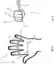 Fig. 03 - Method for determining movement patterns during a dental treatment