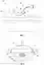 Fig. 02 - SYSTEMS AND METHODS FOR ENHANCING UPTAKE OF THERAPEUTIC AGENT FROM BLOODSTREAM INTO DISEASE SITE