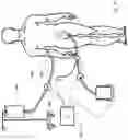 Fig. 29 - SYSTEMS, DEVICES AND METHODS FOR SENSING PHYSIOLOGIC DATA AND DRAINING AND ANALYZING BODILY FLUIDS