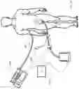 Fig. 31 - SYSTEMS, DEVICES AND METHODS FOR SENSING PHYSIOLOGIC DATA AND DRAINING AND ANALYZING BODILY FLUIDS