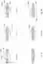 Fig. 35 - SYSTEMS, DEVICES AND METHODS FOR SENSING PHYSIOLOGIC DATA AND DRAINING AND ANALYZING BODILY FLUIDS