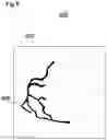 Fig. 07 - Processing image frames of a sequence of cardiac images