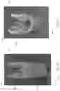 Fig. 22 - Sample retrieval tool with compliant retention member