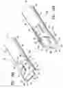 Fig. 20 - Tissue cutting member for a biopsy device