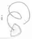Fig. 02 - METHOD AND DEVICES FOR A SUB-SPLENIUS/SUPRA-LEVATOR SCAPULAE SURGICAL ACCESS TECHNIQUE