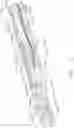 Fig. 12 - Surgical cutting and stapling instruments