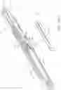 Fig. 158 - Surgical cutting and stapling instruments