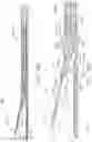 Fig. 80 - Surgical cutting and stapling instruments