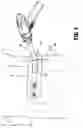 Fig. 04 - Method and apparatus for accessing matter disposed within an internal body vessel