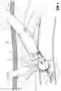 Fig. 06 - Method and apparatus for accessing matter disposed within an internal body vessel