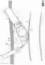 Fig. 07 - Method and apparatus for accessing matter disposed within an internal body vessel