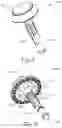 Fig. 04 - METHOD OF APPLYING AN ANNULAR ARRAY OF STAPLES TO TISSUE