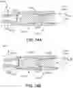 Fig. 100 - METHOD OF APPLYING AN ANNULAR ARRAY OF STAPLES TO TISSUE