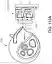 Fig. 147 - METHOD OF APPLYING AN ANNULAR ARRAY OF STAPLES TO TISSUE