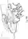 Fig. 170 - METHOD OF APPLYING AN ANNULAR ARRAY OF STAPLES TO TISSUE