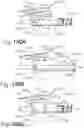 Fig. 171 - METHOD OF APPLYING AN ANNULAR ARRAY OF STAPLES TO TISSUE