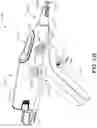 Fig. 173 - METHOD OF APPLYING AN ANNULAR ARRAY OF STAPLES TO TISSUE