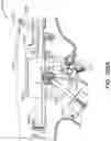Fig. 210 - METHOD OF APPLYING AN ANNULAR ARRAY OF STAPLES TO TISSUE