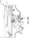 Fig. 212 - METHOD OF APPLYING AN ANNULAR ARRAY OF STAPLES TO TISSUE