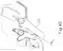Fig. 46 - METHOD OF APPLYING AN ANNULAR ARRAY OF STAPLES TO TISSUE