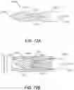 Fig. 98 - METHOD OF APPLYING AN ANNULAR ARRAY OF STAPLES TO TISSUE